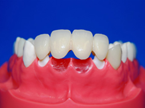 新素材ウェルデンツ